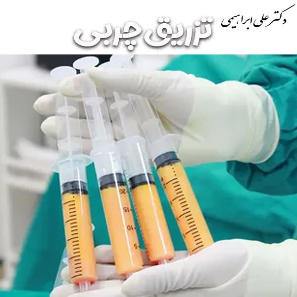 تزریق چربی