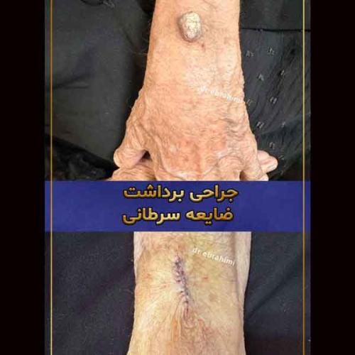 جراحی