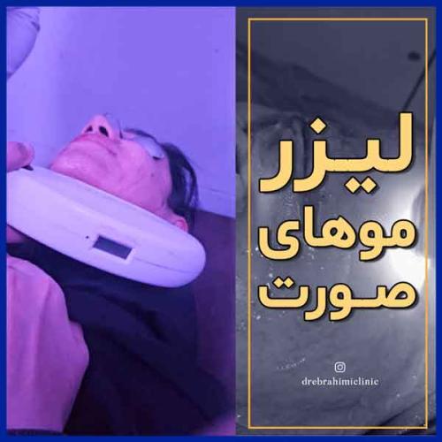 لیزر-1